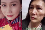 整形失敗，女子被說老，整形前后差異大揭秘(整形失敗過程)