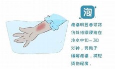 溫泉泡錯方式致燙傷，河南女子的慘痛經歷帶來哪些啟示？