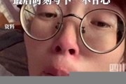 抗癌博主一只羊吖去世，病魔終究未能戰(zhàn)勝堅(jiān)強(qiáng)意志(歌曲一只羊)